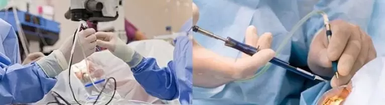 Chirurgija regėjimui atkurti